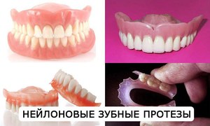 Abnehmbare Nylonzähne - prothetische Option