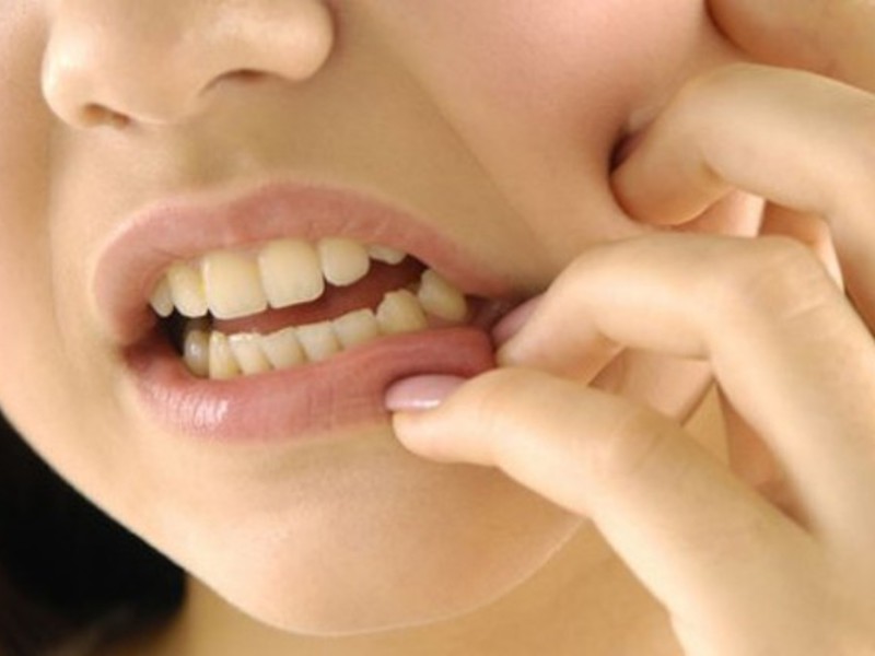 Alveolitis Schmerzen