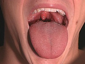 Besondere Anweisungen für die Verwendung von Pasta Solcoseryl Dental